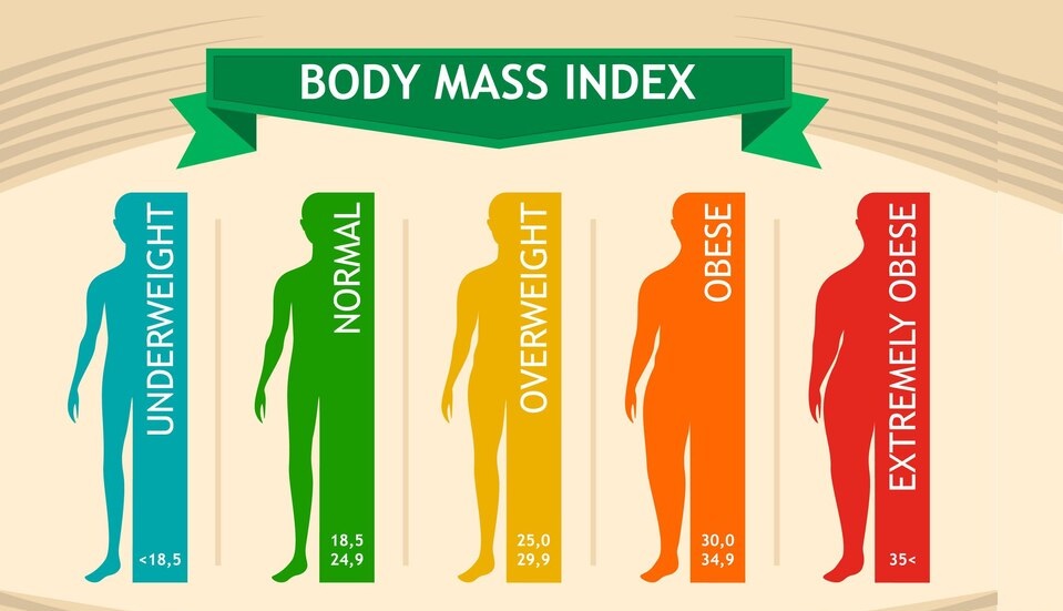 Obesity, Causes, Prevention and Treatment of Obesity?